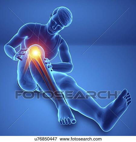 Stock Photo - Man with knee pain, computer illustration.. Fotosearch