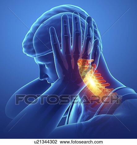 Man with neck pain, computer illustration. View Large Photo Image Stock Image - Man with neck pain, computer illustration.. Fotosearch