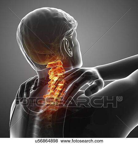 Man with neck pain, computer illustration. View Large Photo Image Stock Photo - Man with neck pain, computer illustration.. Fotosearch