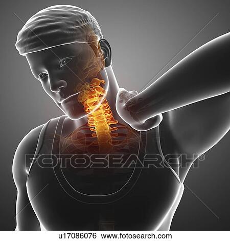 Man with neck pain, computer illustration. View Large Photo Image Stock Photograph - Man with neck pain, computer illustration.. Fotosearch