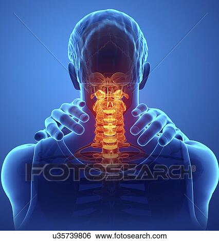 Man with neck pain, computer illustration. View Large Photo Image Stock Photograph - Man with neck pain, computer illustration.. Fotosearch