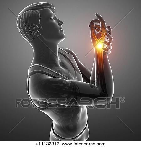 Man with wrist pain, computer illustration. View Large Photo Image Stock Image - Man with wrist pain, computer illustration.. Fotosearch