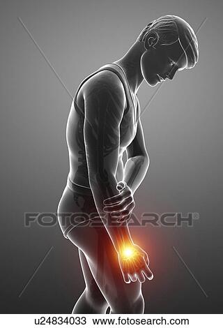 Stock Image - Man with wrist pain, computer illustration.. Fotosearch
