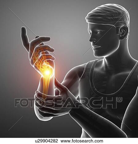 Stock Image - Man with wrist pain, computer illustration.. Fotosearch