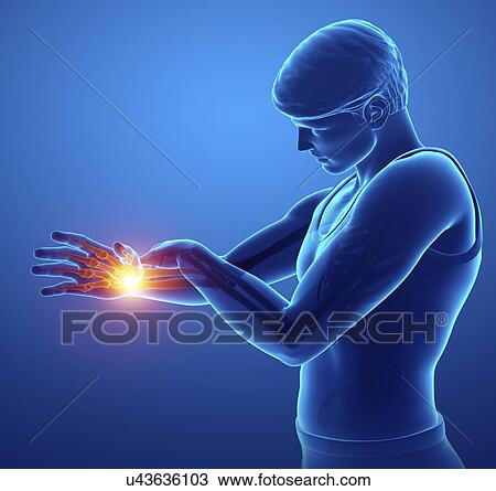 Man with wrist pain, computer illustration. View Large Photo Image Stock Image - Man with wrist pain, computer illustration.. Fotosearch