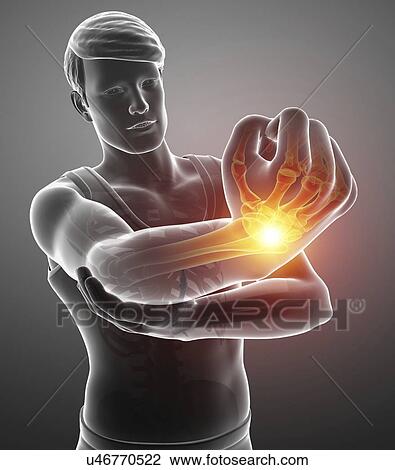 Man with wrist pain, computer illustration. View Large Photo Image Stock Image - Man with wrist pain, computer illustration.. Fotosearch