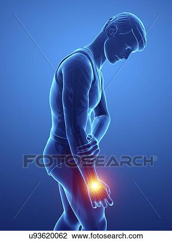 Man with wrist pain, computer illustration. View Large Photo Image Stock Image - Man with wrist pain, computer illustration.. Fotosearch