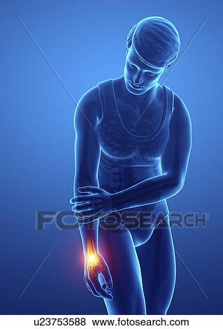 Man with wrist pain, computer illustration. View Large Photo Image Stock Photo - Man with wrist pain, computer illustration.. Fotosearch