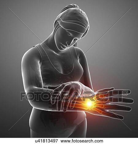 Man with wrist pain, computer illustration. View Large Photo Image Stock Photo - Man with wrist pain, computer illustration.. Fotosearch