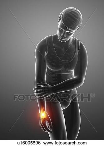 Stock Photograph - Man with wrist pain, computer illustration.. Fotosearch