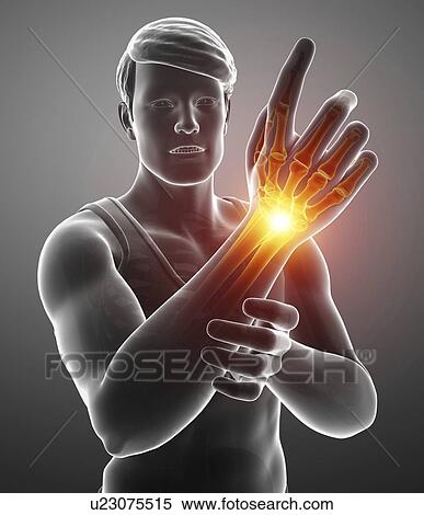 Man with wrist pain, computer illustration. View Large Photo Image Stock Photography - Man with wrist pain, computer illustration.. Fotosearch