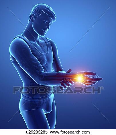 Man with wrist pain, computer illustration. View Large Photo Image Stock Photography - Man with wrist pain, computer illustration.. Fotosearch