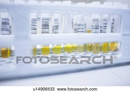 Stock Image - Medical samples in rack, close up.. Fotosearch