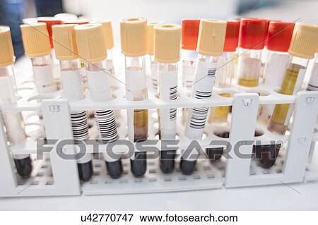 Stock Photo - Medical samples in rack, close up.. Fotosearch