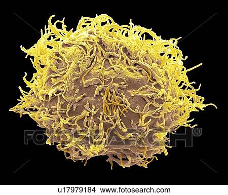 Picture - Mesenchymal stem cell. Coloured scanning electron micrograph (SEM) of a human mesenchymal stem cell (MSC). MSCs are multipotent stromal (connective tissue) cells that can differentiate into a variety of cell types, including osteoblasts (bone cells),.... Fotosearch