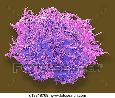 Stock Photo - Mesenchymal stem cell. Coloured scanning electron micrograph (SEM) of a human mesenchymal stem cell (MSC). MSCs are multipotent stromal (connective tissue) cells that can differentiate into a variety of cell types, including osteoblasts (bone cells),.... Fotosearch