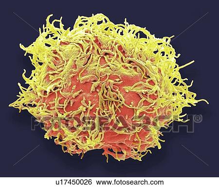 Mesenchymal stem cell. Coloured scanning electron micrograph (SEM) of a human mesenchymal stem cell (MSC). MSCs are multipotent stromal (connective tissue) cells that can differentiate into a variety of cell types, including osteoblasts (bone cells),... View Large Photo Image Stock Photograph - Mesenchymal stem cell. Coloured scanning electron micrograph (SEM) of a human mesenchymal stem cell (MSC). MSCs are multipotent stromal (connective tissue) cells that can differentiate into a variety of cell types, including osteoblasts (bone cells),.... Fotosearch