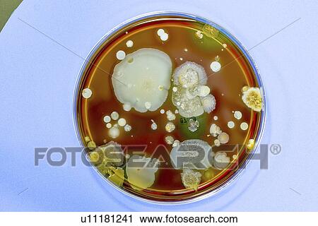 Stock Image - Microbes growing in Petri dish.. Fotosearch