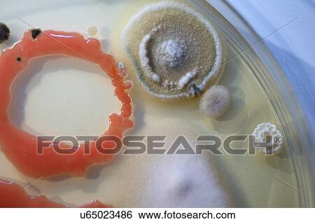 Stock Photograph - Microbes growing on agar.. Fotosearch