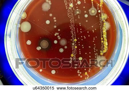 Petri dish with colonies of microbes. View Large Photo Image Stock Photography - Petri dish with colonies of microbes.. Fotosearch
