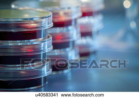 Petri dishes in microbiology lab. View Large Photo Image Stock Image - Petri dishes in microbiology lab.. Fotosearch