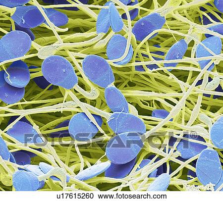 Pig sperm. Coloured scanning electron micrograph (SEM) of immature pig sperm from the epididymis. This immature sperm is characterised by a small amount of unshed residual cytoplasm below the head. The epididymis is a 7 metre long coiled tube that... View Large Photo Image Stock Image - Pig sperm. Coloured scanning electron micrograph (SEM) of immature pig sperm from the epididymis. This immature sperm is characterised by a small amount of unshed residual cytoplasm below the head. The epididymis is a 7 metre long coiled tube that.... Fotosearch