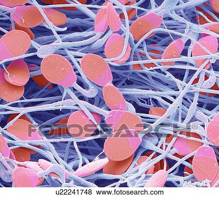 Pig sperm. Coloured scanning electron micrograph (SEM) of immature pig sperm from the epididymis. This immature sperm is characterised by a small amount of unshed residual cytoplasm below the head. The epididymis is a 7 metre long coiled tube that... View Large Photo Image Stock Photo - Pig sperm. Coloured scanning electron micrograph (SEM) of immature pig sperm from the epididymis. This immature sperm is characterised by a small amount of unshed residual cytoplasm below the head. The epididymis is a 7 metre long coiled tube that.... Fotosearch