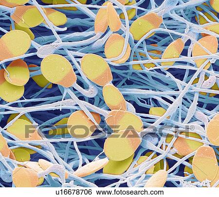 Pig sperm. Coloured scanning electron micrograph (SEM) of immature pig sperm from the epididymis. This immature sperm is characterised by a small amount of unshed residual cytoplasm below the head. The epididymis is a 7 metre long coiled tube that... View Large Photo Image Stock Photograph - Pig sperm. Coloured scanning electron micrograph (SEM) of immature pig sperm from the epididymis. This immature sperm is characterised by a small amount of unshed residual cytoplasm below the head. The epididymis is a 7 metre long coiled tube that.... Fotosearch
