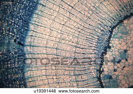 Stock Photo - Plant tissue, light micrograph.. Fotosearch