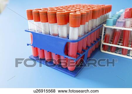 Racks of test tubes. View Large Photo Image Stock Photo - Racks of test tubes.. Fotosearch
