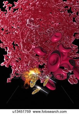 Red blood cells and nanobots, illustration. View Large Photo Image Stock Photo - Red blood cells and nanobots, illustration.. Fotosearch