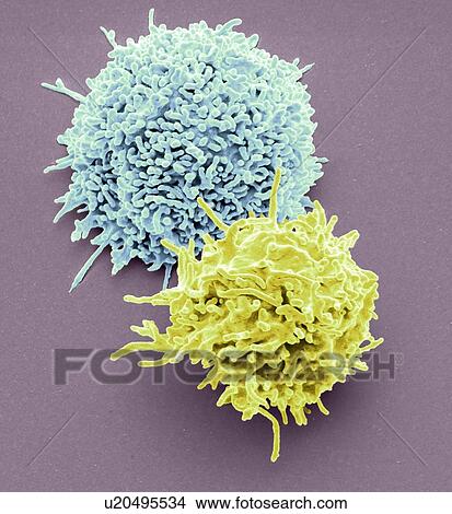 Picture - Resting T lymphocytes. Coloured scanning electron micrograph (SEM) of resting T lymphocytes from a human blood sample. T lymphocytes, or T cells, are a type of white blood cell and components of the body's immune system. They mature in the thymus. T.... Fotosearch
