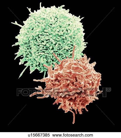 Resting T lymphocytes. Coloured scanning electron micrograph (SEM) of resting T lymphocytes from a human blood sample. T lymphocytes, or T cells, are a type of white blood cell and components of the body's immune system. They mature in the thymus. T... View Large Photo Image Stock Photography - Resting T lymphocytes. Coloured scanning electron micrograph (SEM) of resting T lymphocytes from a human blood sample. T lymphocytes, or T cells, are a type of white blood cell and components of the body's immune system. They mature in the thymus. T.... Fotosearch
