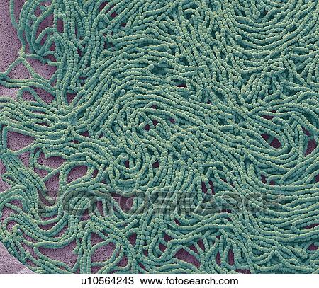 Stock Image - Sputum. Scanning electron micrograph (SEM) of a bacterial culture from sputum. Phlegm is a secretion in the airway during disease and inflammation. Phlegm usually contains mucus with virus, bacteria, other debris, and sloughed-off inflammatory cells..... Fotosearch