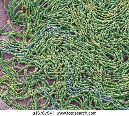 Sputum. Scanning electron micrograph (SEM) of a bacterial culture from sputum. Phlegm is a secretion in the airway during disease and inflammation. Phlegm usually contains mucus with virus, bacteria, other debris, and sloughed-off inflammatory cells.... View Large Photo Image Stock Image - Sputum. Scanning electron micrograph (SEM) of a bacterial culture from sputum. Phlegm is a secretion in the airway during disease and inflammation. Phlegm usually contains mucus with virus, bacteria, other debris, and sloughed-off inflammatory cells..... Fotosearch