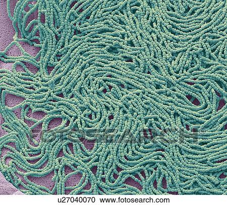 Stock Image - Sputum. Scanning electron micrograph (SEM) of a bacterial culture from sputum. Phlegm is a secretion in the airway during disease and inflammation. Phlegm usually contains mucus with virus, bacteria, other debris, and sloughed-off inflammatory cells..... Fotosearch
