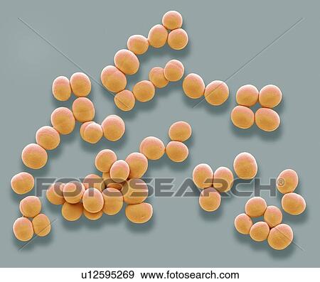 Stock Photo - Staphylococcus aureus. Coloured scanning electron micrograph (SEM) of Staphylococcus aureus bacteria. These Gram-positive bacteria cause skin infections and often grow in these grape-like clusters of small spheres (cocci). S. aureus is extremely.... Fotosearch