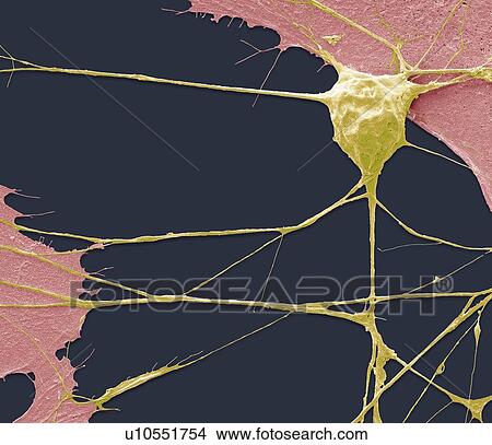 Stem cell-derived motor neuron. Coloured scanning electron micrograph (SEM) of a human nerve cell (neuron) that has been derived from an embryonic pluripotent stem cell (ES). Pluripotent stem cells are able to differentiate into any of the 200 cell... View Large Photo Image Picture - Stem cell-derived motor neuron. Coloured scanning electron micrograph (SEM) of a human nerve cell (neuron) that has been derived from an embryonic pluripotent stem cell (ES). Pluripotent stem cells are able to differentiate into any of the 200 cell.... Fotosearch