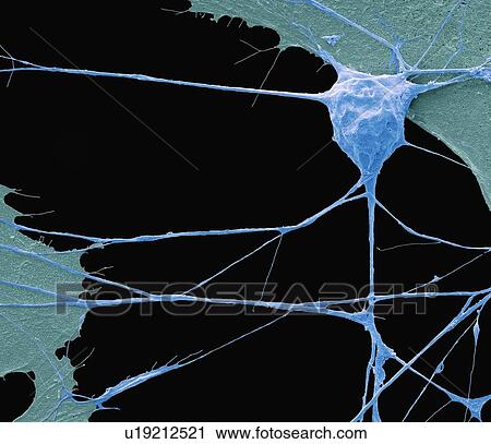 Stem cell-derived motor neuron. Coloured scanning electron micrograph (SEM) of a human nerve cell (neuron) that has been derived from an embryonic pluripotent stem cell (ES). Pluripotent stem cells are able to differentiate into any of the 200 cell... View Large Photo Image Stock Image - Stem cell-derived motor neuron. Coloured scanning electron micrograph (SEM) of a human nerve cell (neuron) that has been derived from an embryonic pluripotent stem cell (ES). Pluripotent stem cells are able to differentiate into any of the 200 cell.... Fotosearch