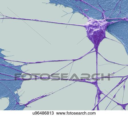 Stem cell-derived motor neuron. Coloured scanning electron micrograph (SEM) of a human nerve cell (neuron) that has been derived from an embryonic pluripotent stem cell (ES). Pluripotent stem cells are able to differentiate into any of the 200 cell... View Large Photo Image Stock Image - Stem cell-derived motor neuron. Coloured scanning electron micrograph (SEM) of a human nerve cell (neuron) that has been derived from an embryonic pluripotent stem cell (ES). Pluripotent stem cells are able to differentiate into any of the 200 cell.... Fotosearch
