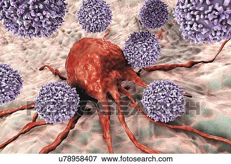 Stock Photo - T lymphocyte cells attacking a cancer cell, computer illustration. T lymphocytes are a type of white blood cell that recognise a specific site (antigen) on the surface of cancer cells or pathogens and bind to it. Some T lymphocytes then signal for.... Fotosearch