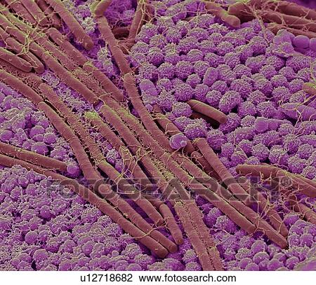 Tongue bacteria. Coloured scanning electron micrograph (SEM) of bacteria on the surface of a human tongue. Large numbers of bacteria can form a visible layer on the surface of the tongue. The mouth contains a large number of bacteria, most of which... View Large Photo Image Stock Image - Tongue bacteria. Coloured scanning electron micrograph (SEM) of bacteria on the surface of a human tongue. Large numbers of bacteria can form a visible layer on the surface of the tongue. The mouth contains a large number of bacteria, most of which.... Fotosearch