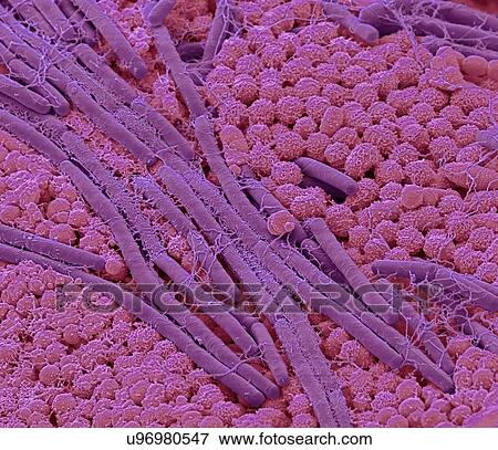 Stock Photo - Tongue bacteria. Coloured scanning electron micrograph (SEM) of bacteria on the surface of a human tongue. Large numbers of bacteria can form a visible layer on the surface of the tongue. The mouth contains a large number of bacteria, most of which.... Fotosearch