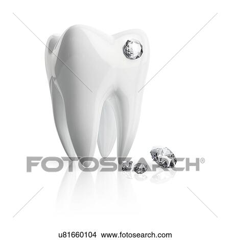 Tooth piercing, illustration. View Large Photo Image Picture - Tooth piercing, illustration.. Fotosearch