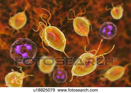 Stock Photo - Trichomonas vaginalis and neutrophils, computer illustration. Trichomonas vaginalis is a parasitic microorganism that is the causative agent of trichomoniasis. Trichomoniasis is a common cause of vaginitis and is a sexually transmitted disease. Smears.... Fotosearch