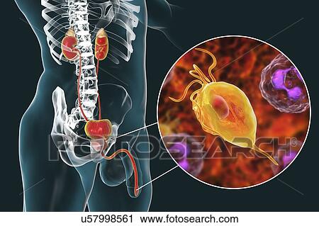 Stock Image - Trichomoniasis. Computer illustration of the male urinary system and the parasitic microorganism Trichomonas vaginalis, which is the causative agent of trichomoniasis. Trichomoniasis is a common cause of urethritis and prostatitis in men and is a.... Fotosearch