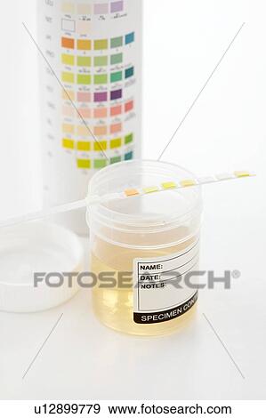 Stock Photo - Urine sample for analysis and test strip, studio shot.. Fotosearch