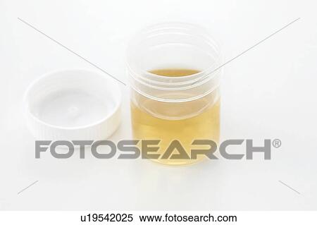 Stock Photography - Urine sample for analysis, studio shot.. Fotosearch