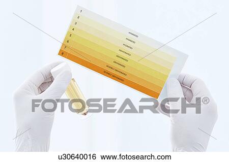 Urine sample in container and chart, studio shot. View Large Photo Image Stock Photograph - Urine sample in container and chart, studio shot.. Fotosearch