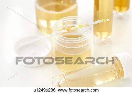 Stock Photograph - Urine samples for analysis and test strip, studio shot.. Fotosearch